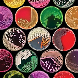 几种常见的微生物培养基及应用
