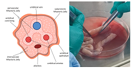 人脐带间质干细胞分离培养测试