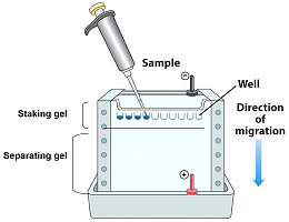 Western Blot 实验中磷酸化蛋白检测的关键要点与注意事项