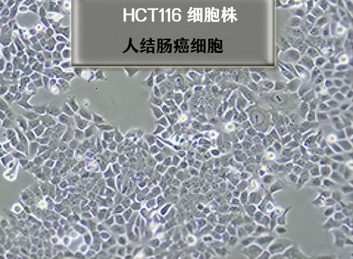hct116细胞株