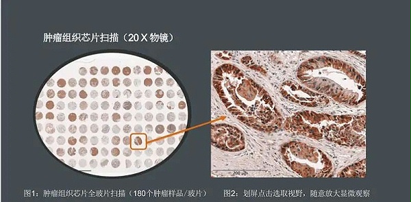 组织切片