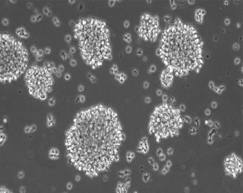 NK-92细胞-人恶性非霍奇金淋巴瘤的自然杀伤细胞